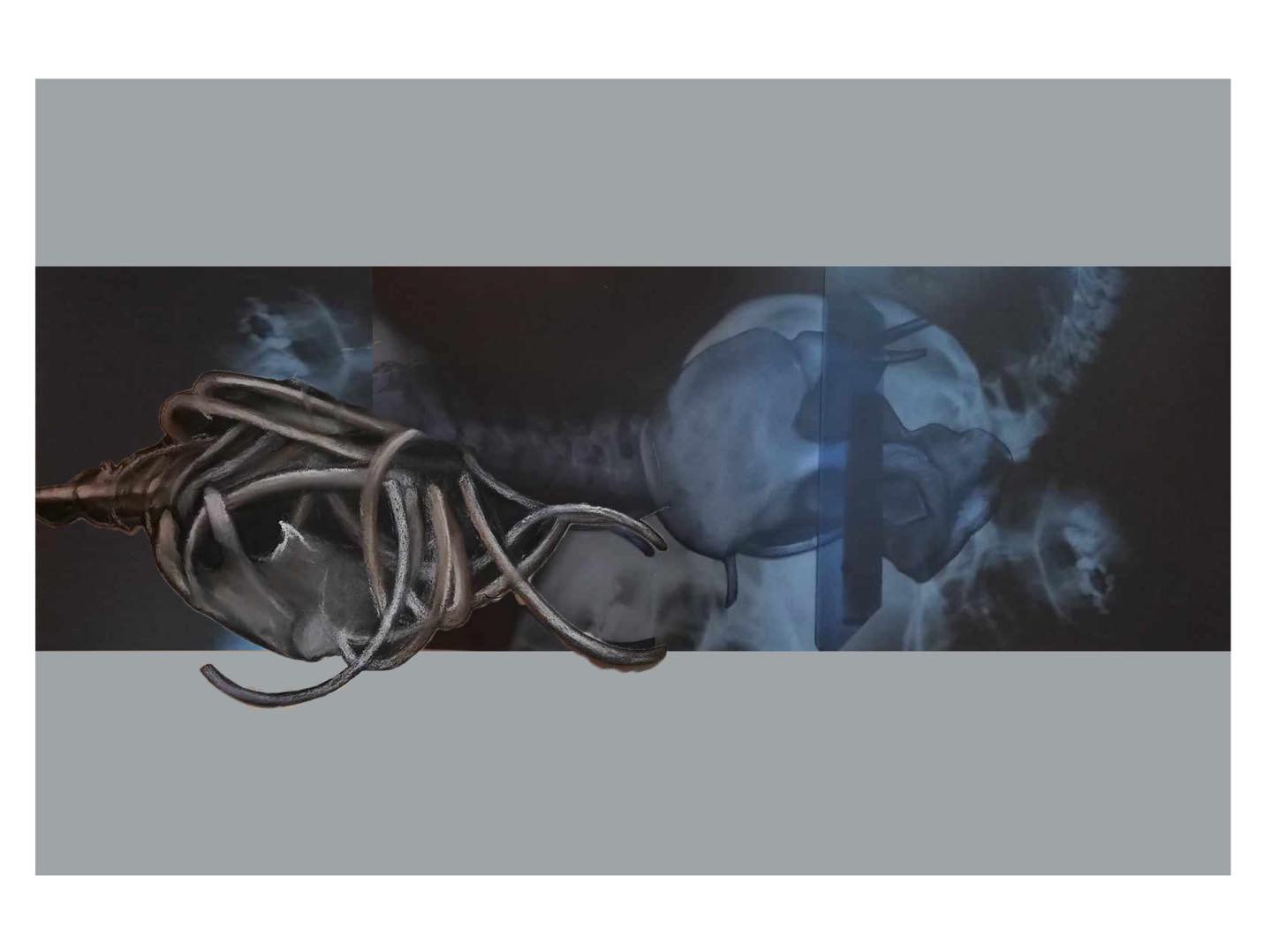 Obraz zawierający w sobie elementy zdjęcia rentgenowskiego oraz rysunku ludzkiego szkieletu